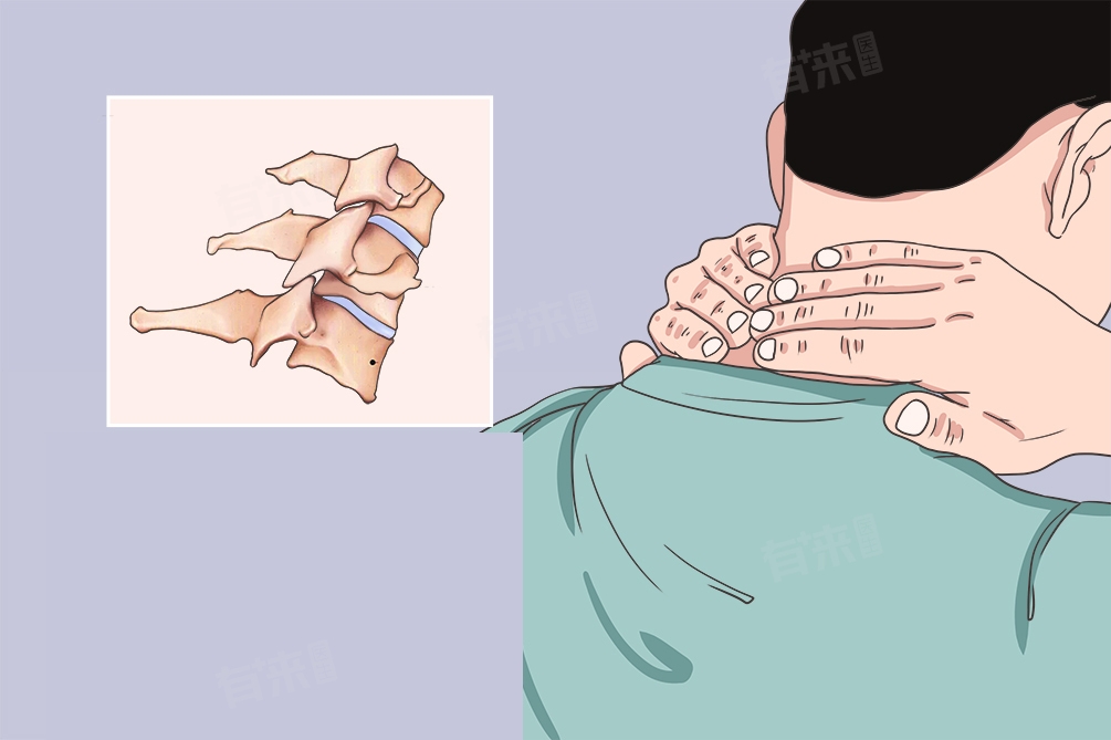 Treatment methods for cer